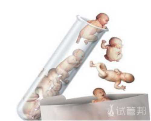 <b>广州个人找代孕妈妈有做的吗|常德第一人民医院做试管哪个医生好？选择医生</b>